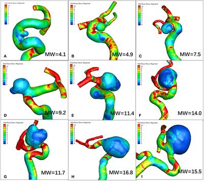 Sidewall Aneurysm Geometry as a Predictor of Rupture Risk Due to Associated Abnormal Hemodynamics